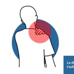 Inflammation